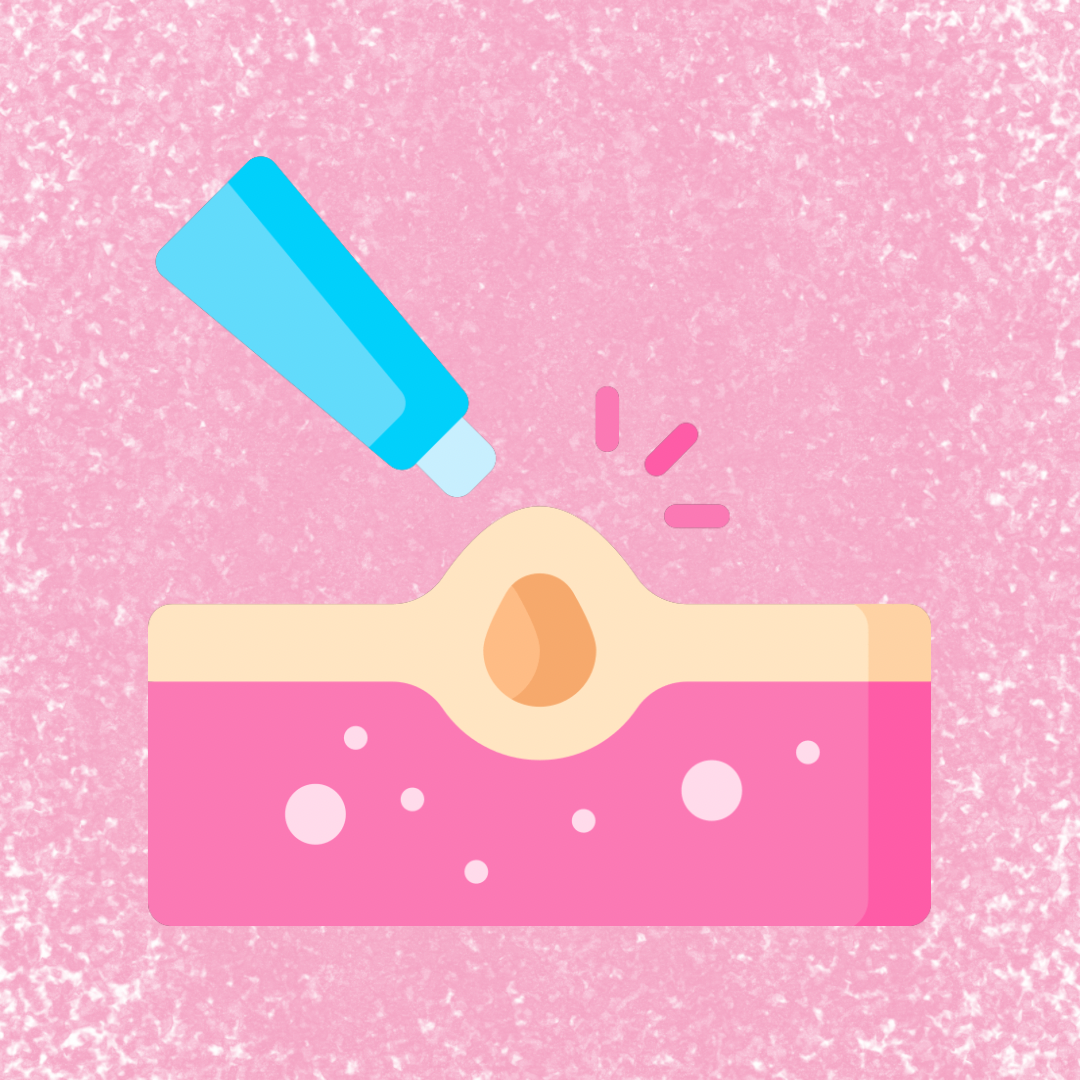 Acne Treatment