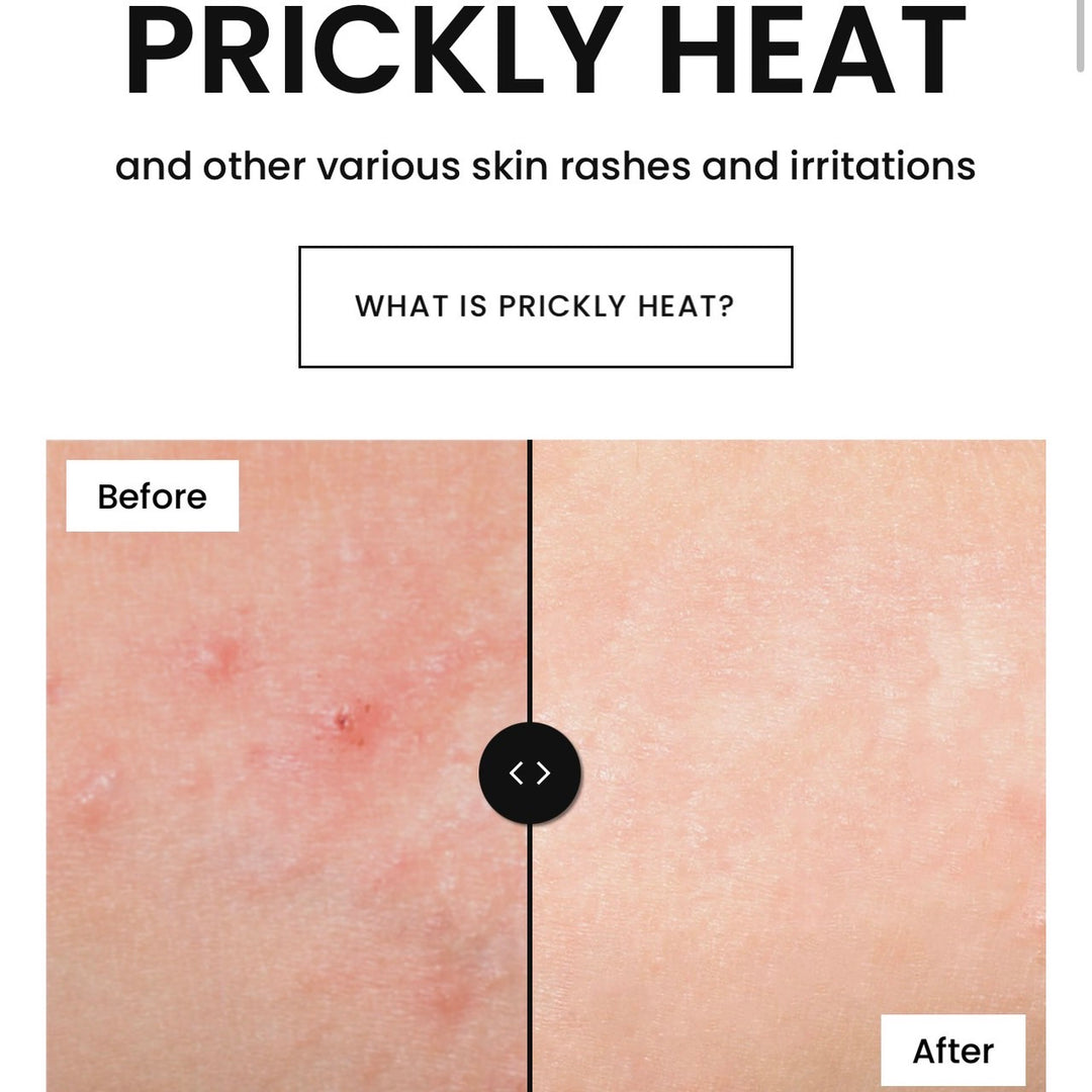 Snake Brand Prickly Heat Classic