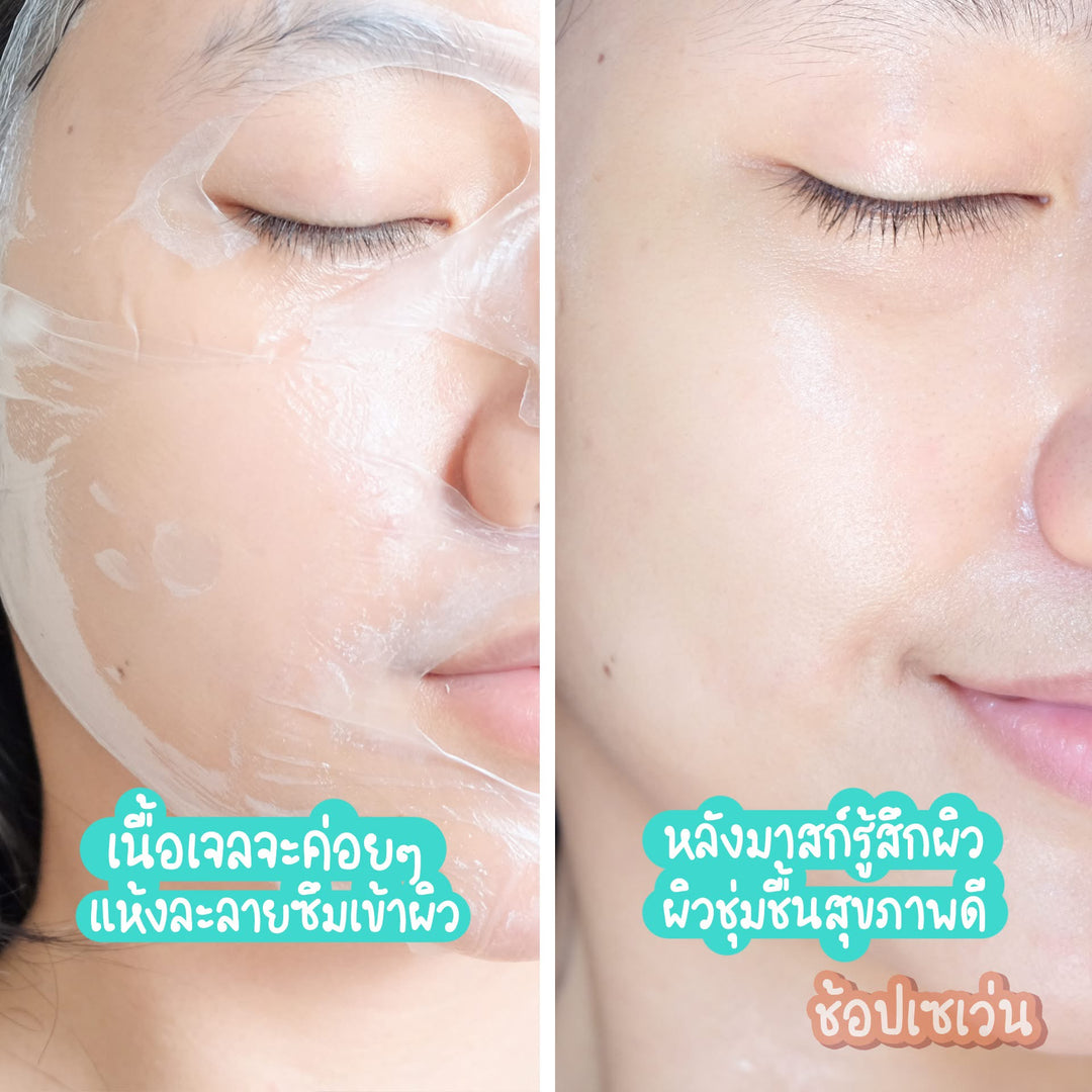 Baby Bright Hydrogel Mask EXOWHITE™