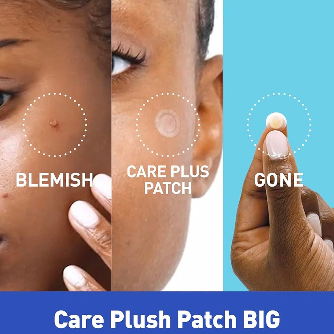 Korea’s #1 Olive Young acne patch — thin, invisible, long-lasting