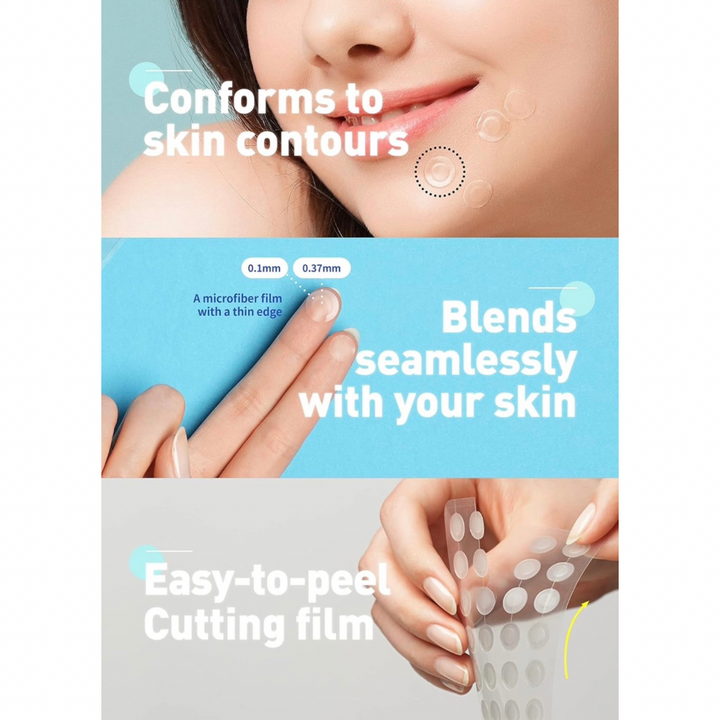 Korea’s #1 Olive Young acne patch — thin, invisible, long-lasting