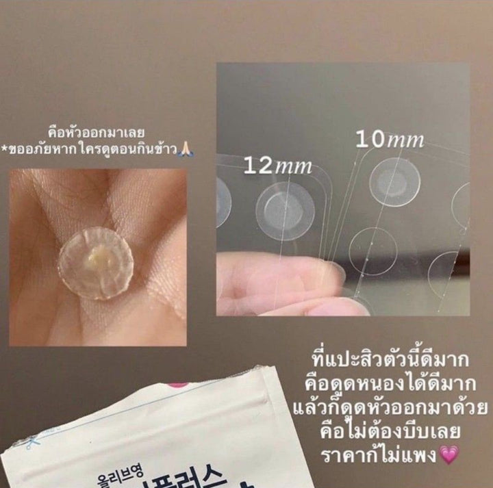 Korea’s #1 Olive Young acne patch — thin, invisible, long-lasting