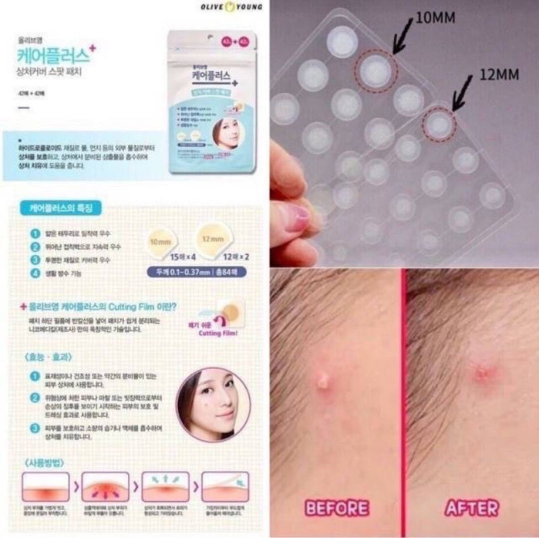 Korea’s #1 Olive Young acne patch — thin, invisible, long-lasting