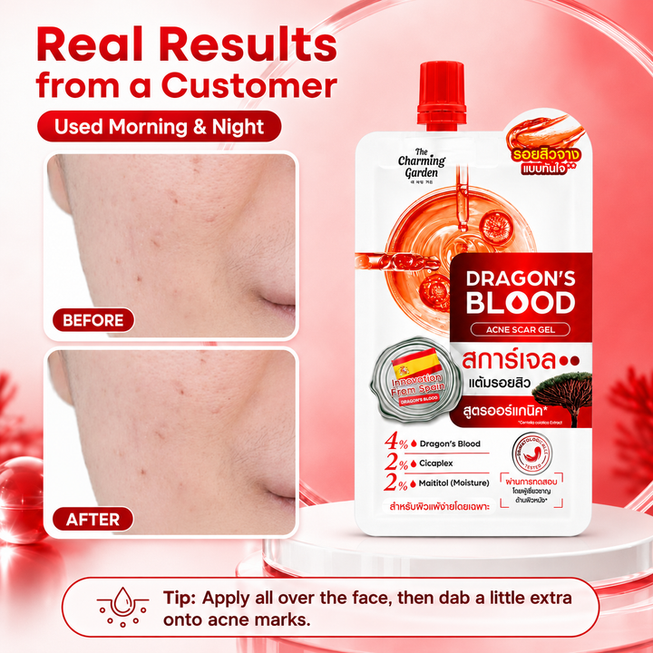 The Charming Garden Dragon’s Blood Acne Scar Gel